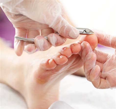 Foot Care Treatments in Ottawa | Natural Sole Wellness