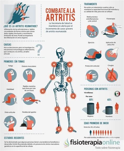 ¿Qué es la artritis reumatoide y qué diferencia la artritis de la artrosis? | Fisioterapia Online