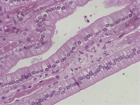 simple squamous epithelium histology - Google Search | Anatomy and physiology, Medical science ...