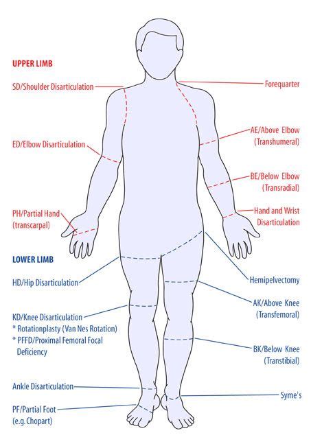 Amputations | Physical therapy student, Medical information, Amputee