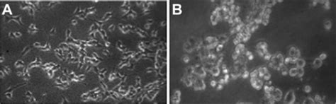 Morphology of human skin malignant melanoma cells A375. (A) Control ...