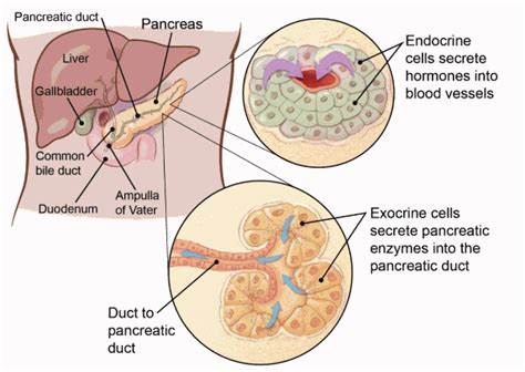 What Is a Pancreatic Neuroendocrine Tumor?