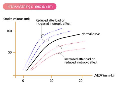 Ventricular Pressure-Volume Relationship: Preload, Afterload, Stroke ...