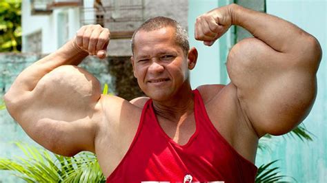 Man Has Biggest Biceps In The World - YouTube