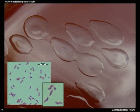 Campylobacter jejuni with microscopy