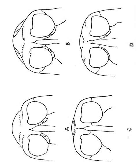 Figure 4 from The skull and mandible of the South African baboon ...