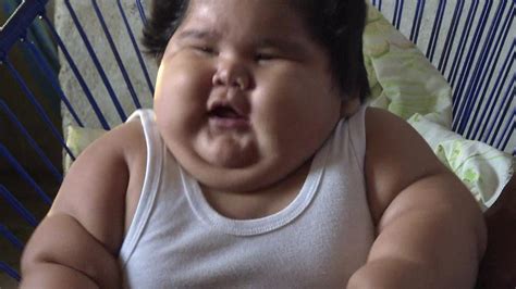 Obese Baby