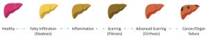 LiverMultiScan - Gastro