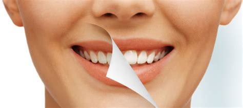 Laser Teeth Whitening, Near Me, Pros and Cons, Side Effects, Reviews ...