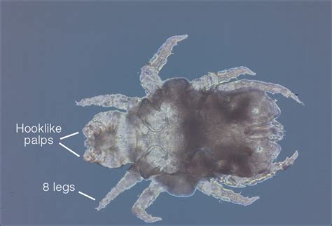 What’s Eating You? Cheyletiella Mites | MDedge Dermatology