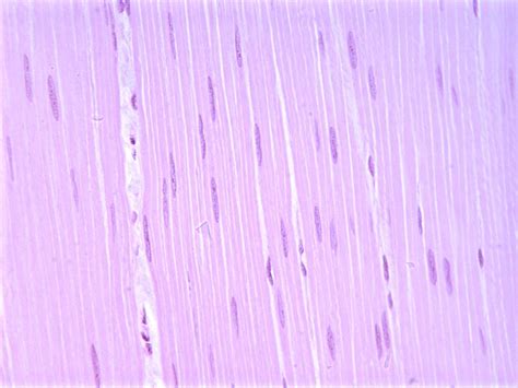 Chapter 7, Page 10 - HistologyOLM 4.0 | Tissue types, Smooth muscle tissue, Human tissue