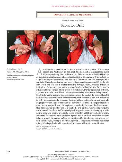 Pronator drift NEJM Neurological Assessment - images in clinical ...