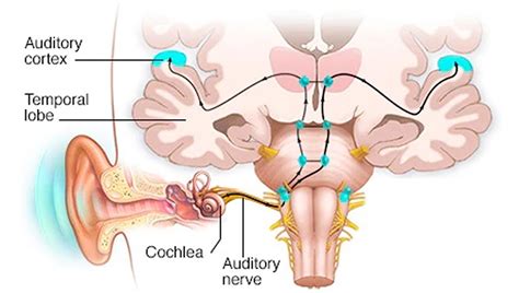 Auditory cortex, auditory area of brain location & function