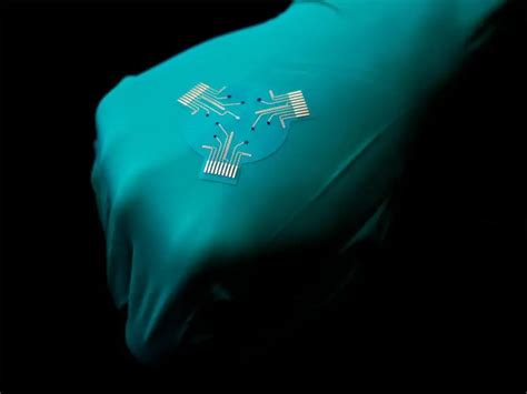 “Smart” Bandages: A Cheaper, Easier, and More Effective Way To Treat Chronic Wounds