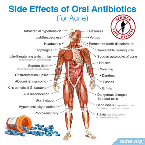 What Is an Acne Nodule? - Acne.org