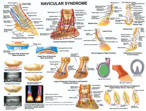 Navicular Syndrome Chart-www.hoofprints.com