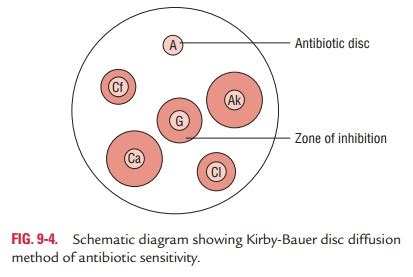 Antibiotic Sensitivity Testing