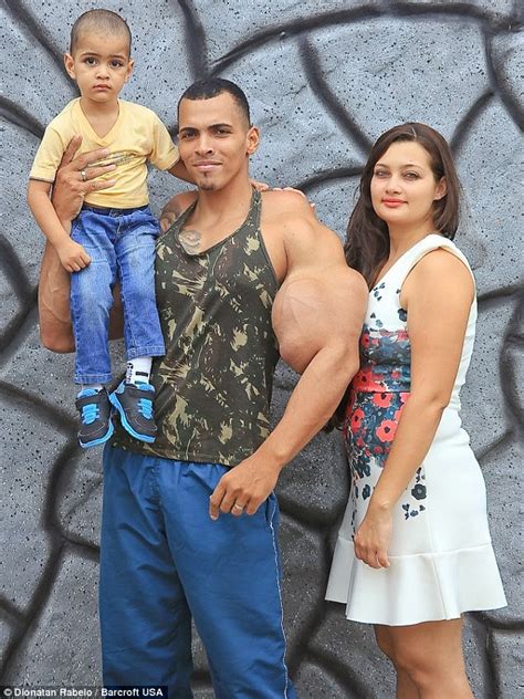 Meet the incredible hulk from Brazil, who injected oil into his biceps in bid to become real ...