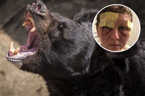 'I Was Attacked by a Bear, This Is How I Survived' - Newsweek