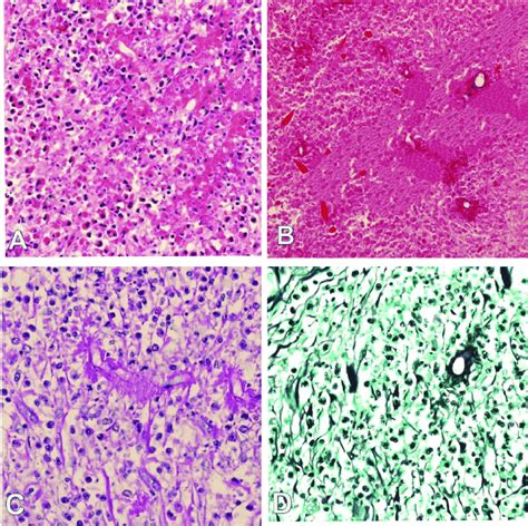 (A-D): Histopathologic section of cecum. A: Multiple areas of mucosal ...