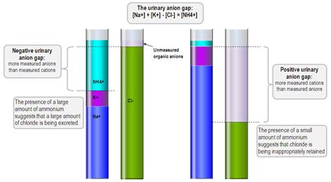 The diagnostic utility of urinary electrolytes | Deranged Physiology