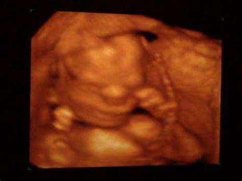 16 WEEK GENDER REVEAL! AMAZING 3D & 4D ULTRASOUND! - YouTube