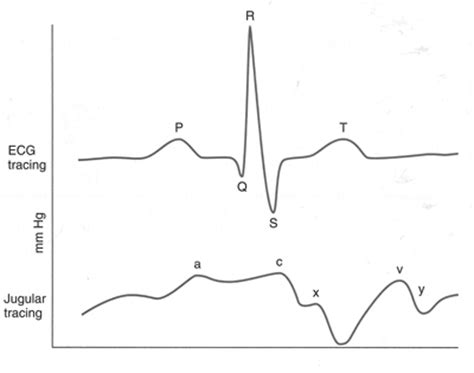 JVP waveform | MBBS4 Experiences