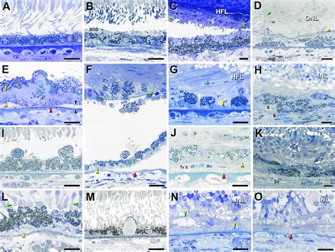 Fifteen phenotypes of retinal pigment epithelial cell morphology in ...