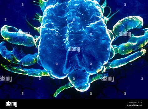 CRAB LOUSE, SEM Stock Photo - Alamy