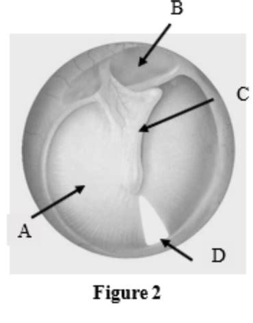 Labeled ear drum Diagram | Quizlet