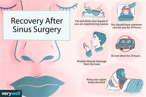 Functional Endoscopic Sinus Surgery: Prep and Recovery