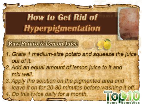 How to Get Rid of Hyperpigmentation | Top 10 Home Remedies