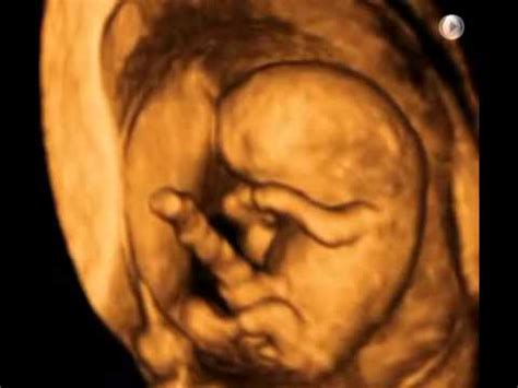 9 Weeks Pregnant 3d Ultrasound