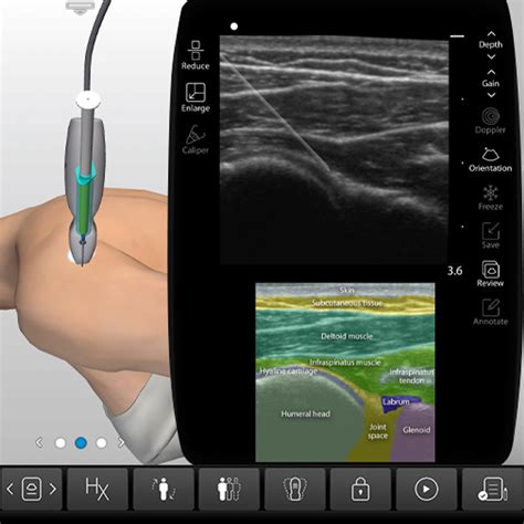 Glenohumeral Joint Injection Ultrasound - Procedure Training