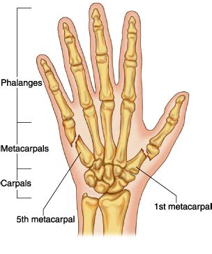 An Introduction to 5th Metacarpal Fracture and Its Treatments | New Health Advisor