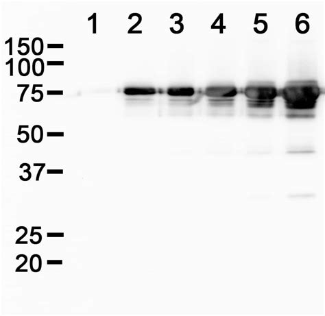 Streptolysin Antibody (6D11) - BSA Free (NBP1-05126): Novus Biologicals