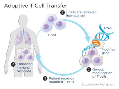 Immunotherapy | LUNGevity Foundation