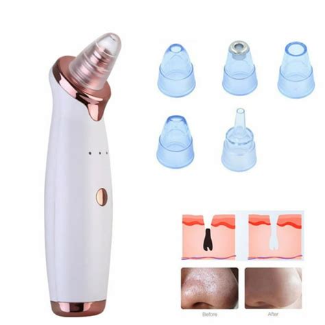 Blackhead Remover Pore Vacuum - Blackhead Removal Tool with 5 Replaceable Suction Probes (White ...