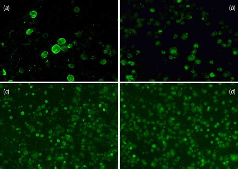 Microscopy of varicella-zoster virus-infected cells used in the ...