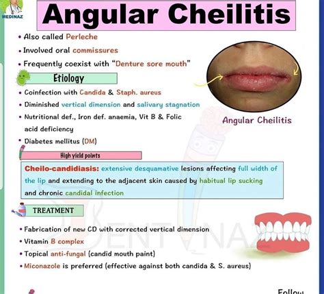 Gulf View Medical Centre Angular Cheilitis, Also Known As, 49% OFF