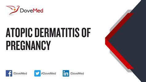 Atopic Dermatitis of Pregnancy - DoveMed