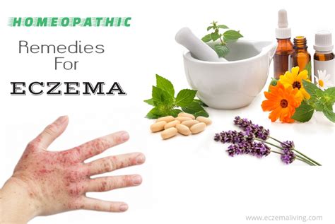 Homeopathy For Eczema - Best 7 Eczema Homeopathic Remedies