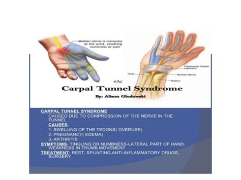 Peripheral nerve injury