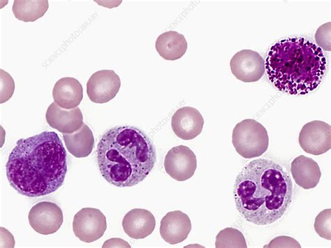 Peripheral blood smear, LM - Stock Image - C036/2224 - Science Photo Library