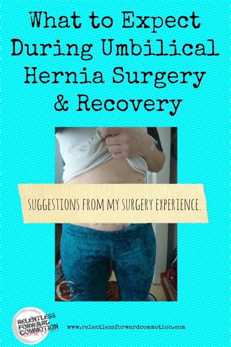 What to Expect During Umbilical Hernia Surgery Recovery | Umbilical hernia, Surgery recovery ...