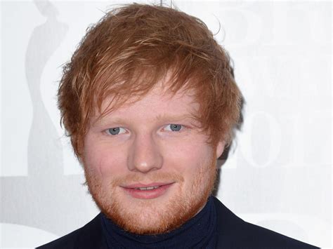 James Blunt calls bullsh*t on Ed Sheeran’s I-was-cut-in-the-face-with-a ...