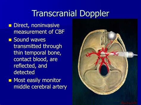 PPT - Neurological Monitoring PowerPoint Presentation - ID:397347