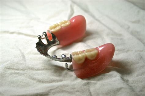 Partial Dentures — Sturgeon Denture Clinic