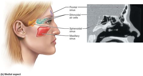 Sinus Infection - Causes, Symptoms, Diagnosis, Treatment & Home Remedies