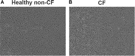 Frontiers | Use of a Primary Epithelial Cell Screening Tool to Investigate Phage Therapy in ...